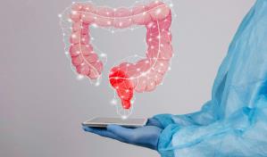 El cáncer colorrectal se protege de la inmunoterapia con un doble escudo, según un estudio