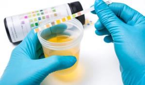 Identifican en Brasil proteínas que pueden permitir el diagnóstico del autismo en la orina