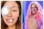 Fan de Karol G sufre heridas en el ojo por la pirotecnia durante su concierto en Lima Fan de Karol G sufre heridas en el ojo por la pirotecnia durante su concierto en Lima