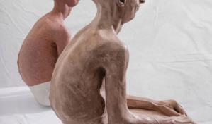 Identifican las c&eacute;lulas clave para prevenir la aterosclerosis en el s&iacute;ndrome de progeria