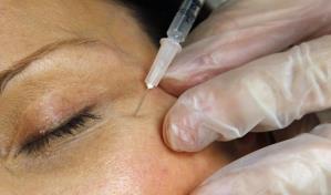 Autoridades de salud de EE. UU. alertan sobre inyecciones con bótox falso