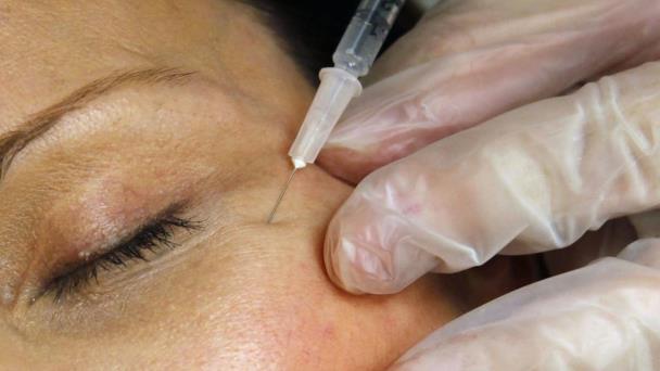 Autoridades de salud de EE. UU. alertan sobre inyecciones con bótox falso