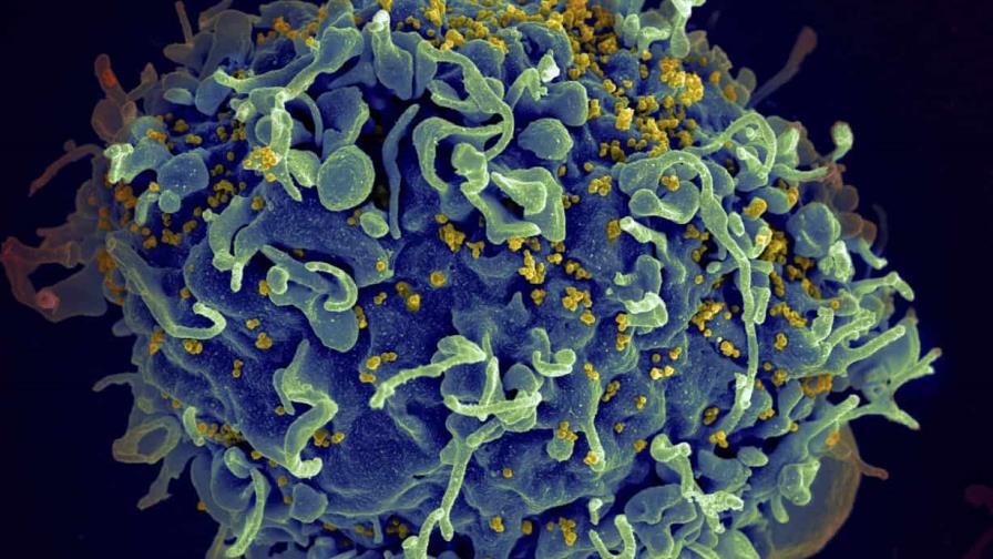 CDC identifica primeros casos documentados de VIH por "faciales vampíricos"