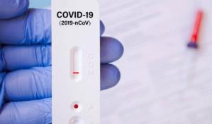 El 75 % de los casos de COVID-19 detectados esta semana fue en la provincia Duarte