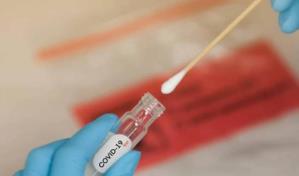 De 913 pruebas Covid realizadas en la última semana, solo 17 resultaron positivas