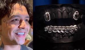 Christian Nodal se cambió la dentadura por diamantes y ahora se arrepiente