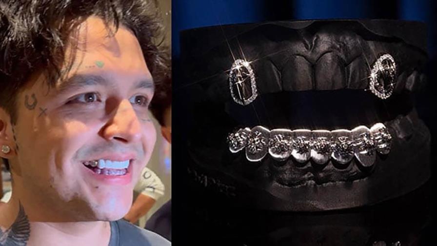 Christian Nodal se cambió la dentadura por diamantes y ahora se arrepiente