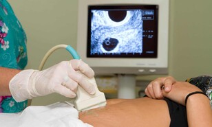 La verdadera causal: proteger la vida y acompa&ntilde;ar a la mujer