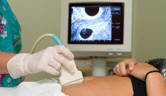 La verdadera causal: proteger la vida y acompa&ntilde;ar a la mujer