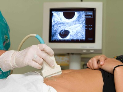 Proteger la vida y acompañar a la mujer, la verdadera causal