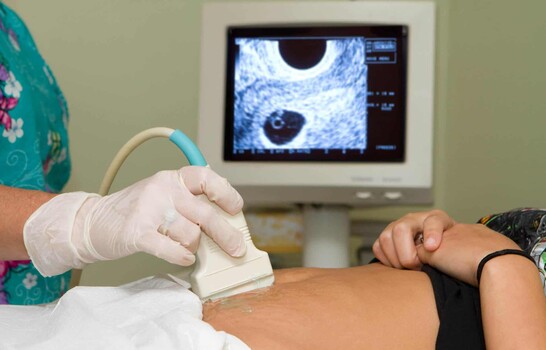 La verdadera causal: proteger la vida y acompa&ntilde;ar a la mujer