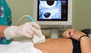 En medio de cambios al Código Penal, depositan propuesta para incluir causales del aborto