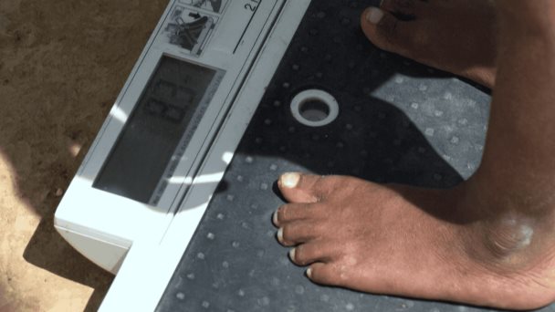 Unicef alerta sobre pobreza alimentaria