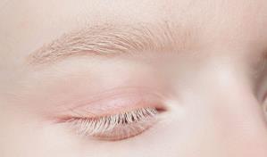 Aurora: Una historia sobre el albinismo y sus desafíos