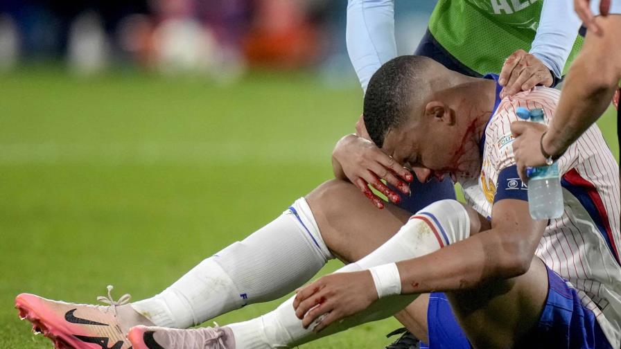 Mbappé se fractura la nariz, regresa a la concentración y jugará con máscara