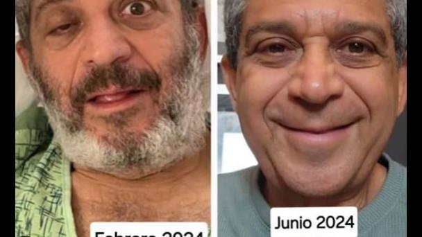 La enfermedad que mantuvo postrado en una cama al padrastro de Zoe Saldaña