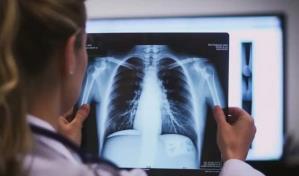 Mujer de Connecticut contrae infección mortal similar a un brote en Japón