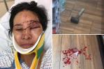 Tengo miedo ahora, el relato de una empleada golpeada con un martillo en una bodega de NY