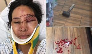 Tengo miedo ahora, el relato de una empleada golpeada con un martillo en una bodega de NY