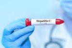 Salud Pública reporta 812 casos de hepatitis C, con mayor incidencia en mujeres