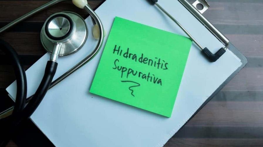 Lo que debes saber de los molestos golondrinos