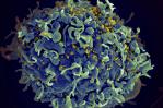 Pacientes seropositivos en remisión, una prueba viviente de esperanza en la lucha contra el virus del sida Pacientes seropositivos en remisión, una prueba viviente de esperanza en la lucha contra el virus del sida