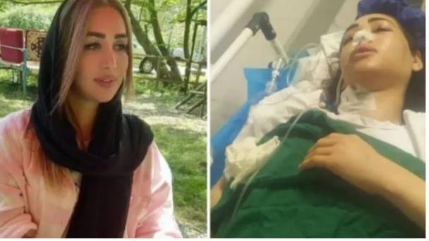 Una mujer herida de bala en Irán por no llevar velo islámico queda paralítica