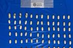 Detienen a un nigeriano en aeropuerto de Punta Cana con 72 bolsitas de cocaína en el estómago Detienen a un nigeriano en aeropuerto de Punta Cana con 72 bolsitas de cocaína en el estómago