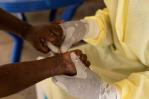 Cuba afirma que no hay casos de la nueva variante de Mpox en la isla Cuba afirma que no hay casos de la nueva variante de Mpox en la isla