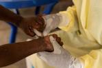 Las autoridades sanitarias de Puerto Rico, vigilantes ante la nueva variante del mpox Las autoridades sanitarias de Puerto Rico, vigilantes ante la nueva variante del mpox