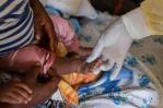 España vigila la nueva variante del mpox y recomienda vacuna España vigila la nueva variante del mpox y recomienda vacuna