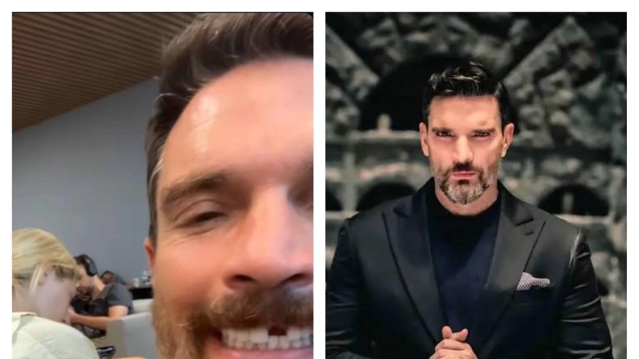 Julián Gil perdió un diente durante la grabación del reality show  "La Isla: Desafío Extremo"