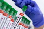 México admite trámite de registro sanitario para vacuna contra mpox, antes viruela símica