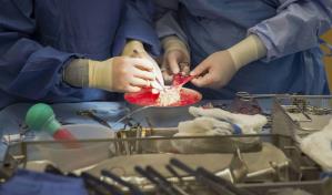 Donar un ri&ntilde;&oacute;n es ahora m&aacute;s seguro de lo que se pensaba, revela estudio de EEUU