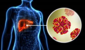 Hepatitis B y C tienen mayor potencial de convertirse en enfermedades crónicas