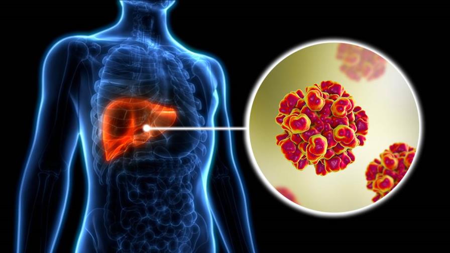 Hepatitis B y C tienen mayor potencial de convertirse en enfermedades crónicas