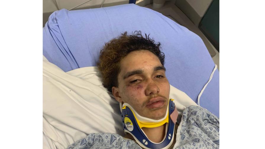 Joven transgénero en Massachusetts denuncia haber sido atacado en fiesta