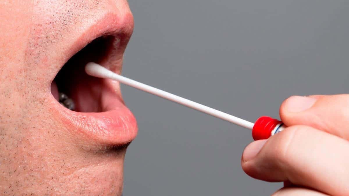 Los métodos más exactos son los de sangre y mucosa oral (saliva). 