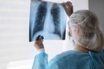 Con inmunoterapia se curan más pacientes de cáncer de mama triple negativo, según estudio Con inmunoterapia se curan más pacientes de cáncer de mama triple negativo, según estudio