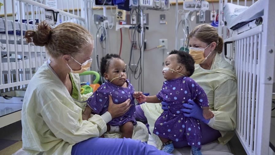 Dos gemelos nacidos siameses celebran su primer cumpleaños después de una cirugía de separación