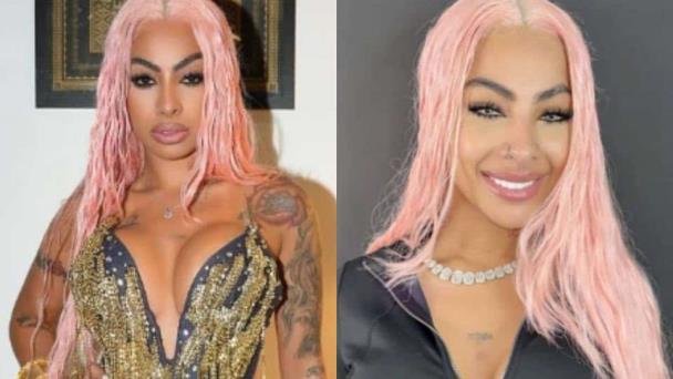 Cómo Yailin la Más Viral cambió el color de sus ojos y cuáles son los riesgos