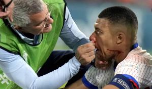 Costo de número de lesiones en fútbol europeo se acerca a los 800 millones de dólares, según informe