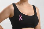 El 57 % de los casos de cáncer de mama en el país se diagnostican en etapa avanzada El 57 % de los casos de cáncer de mama en el país se diagnostican en etapa avanzada