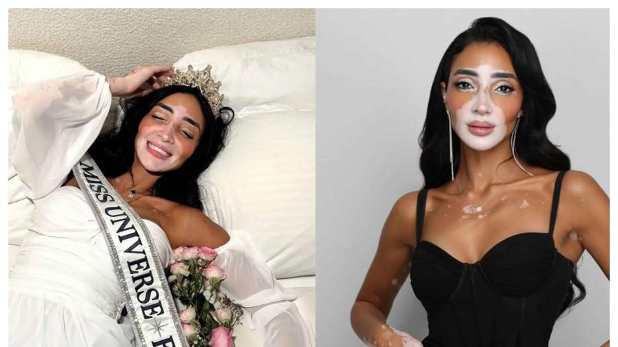 Egipto corona a la primera aspirante a Miss Universo con vitiligo