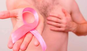 ¿Cuáles son las señales de alerta del cáncer de mama en el hombre?
