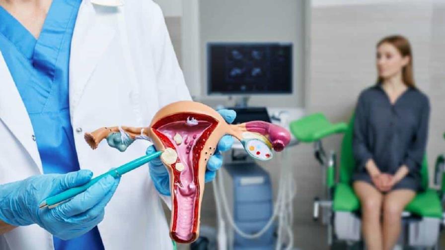 Fibromas uterinos: opciones para tratarlos más allá de la histerectomía