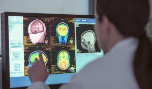 Estimulación pionera de una región cerebral devuelve la capacidad de andar a parapléjicos