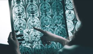 La obesidad puede aumentar el riesgo de padecer Alzheimer, según un estudio