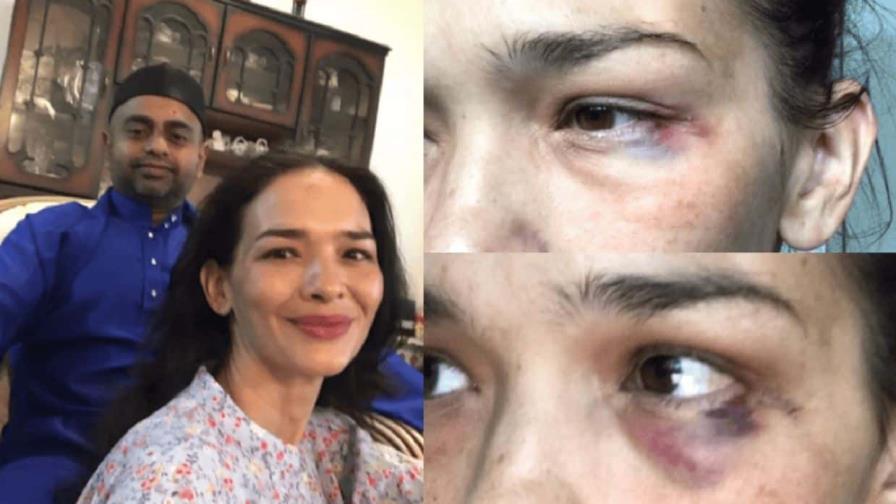 Una actriz malasia publica un ojo morado en Instagram para denunciar violencia doméstica