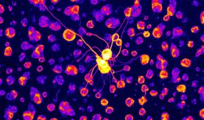 Una investigaci&oacute;n biom&eacute;dica revela el papel crucial de unos genes en el autismo idiop&aacute;tico